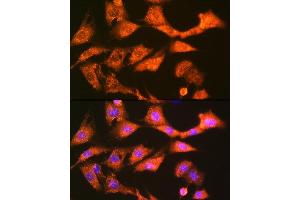 Immunofluorescence analysis of NIH-3T3 cells using GSTK1 Rabbit mAb (ABIN7267442) at dilution of 1:100 (40x lens). (GSTK1 抗体)