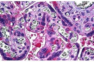 Human Placenta: Formalin-Fixed, Paraffin-Embedded (FFPE) (DIAPH2 抗体  (AA 56-114))