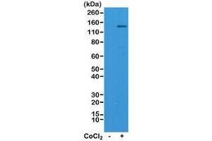 Western blot test of Jurkat cell lysate, untreated or treated with Cobalt Chloride (CoCl2), using recombinant HIF1A antibody at 1:1000. (Recombinant HIF1A 抗体)