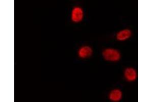 ABIN6278024 staining HepG2 by IF/ICC. (HLF 抗体)