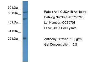 WB Suggested Anti-GUCA1B  Antibody Titration: 0. (GUCA1B 抗体  (N-Term))