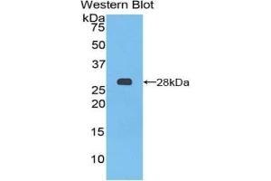 Detection of Recombinant PTCH1, Mouse using Polyclonal Antibody to Patched Homolog 1 (PTCH1) (Patched 1 抗体  (AA 213-422))