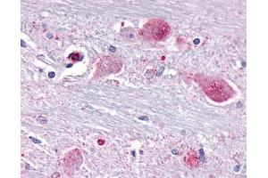 Anti-NR1D1 antibody IHC of human brain, neurons and glia. (NR1D1 抗体  (Internal Region))