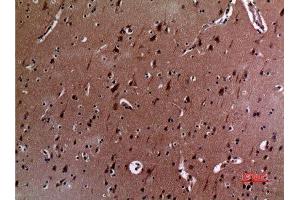 Immunohistochemistry (IHC) analysis of paraffin-embedded Human Brain, antibody was diluted at 1:100. (IL12A 抗体  (Internal Region))