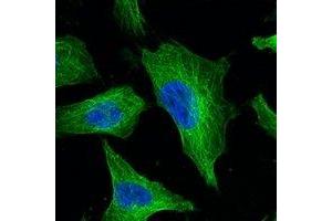 Immunofluorescent analysis of Beta-tubulin staining in Hela cells. (TUBB 抗体)
