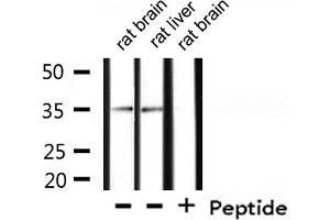 Western Blotting (WB) image for anti-Casein Kinase 1, alpha 1 (CSNK1A1) (Internal Region) antibody (ABIN6257059)