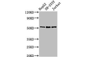 Western Blot Positive WB detected in: HepG2 whole cell lysate, SH-SY5Y whole cell lysate, Jurkat whole cell lysate All lanes: PRKN antibody at 3 μg/mL Secondary Goat polyclonal to rabbit IgG at 1/50000 dilution Predicted band size: 52, 49, 24, 31, 43, 36, 44, 47 kDa Observed band size: 52 kDa (Parkin 抗体  (AA 1-465))