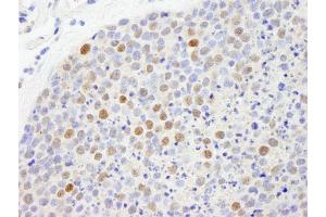 Immunohistochemistry (IHC) image for anti-Chromobox Homolog 5 (CBX5) (C-Term) antibody (ABIN7448461) (CBX5 抗体  (C-Term))