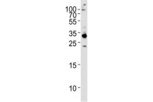 Western blot analysis of HeLa lysate and RPS6 antibody used at 1:1000.
