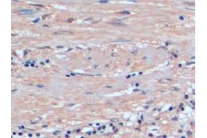 Immunohistochemistry (IHC) image for anti-Glutathione S-Transferase pi 1 (GSTP1) (AA 1-210) antibody (ABIN7433147)