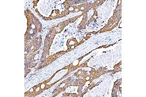 IHC analysis of STON1 using anti-STON1 antibody (ABIN7599896).
