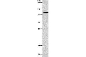 Western blot analysis of 231 cell, using TNK2 Polyclonal Antibody at dilution of 1:1800 (TNK2 抗体)