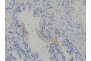 DAB staining on IHC-P; Samples: Human Prostate Tissue (Arc 抗体  (AA 96-356))