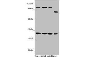 Western blot All lanes: MTIF3 antibody at 1.