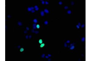 Immunofluorescence staining of MCF-7 cells with ABIN7127308 at 1:56,counter-stained with DAPI. (Recombinant HIST1H1E 抗体  (pThr17))
