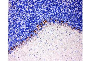 Anti-GABA Transporter 1/GAT 1 antibody, IHC(P) IHC(P): Rat Brain Tissue (SLC6A1 抗体  (C-Term))