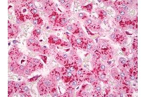 Anti-CYSLT2 / CYSLTR2 antibody IHC of human liver, Kupffer cells. (CasLTR2 抗体)