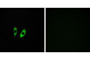 Peptide - +Western blot analysis of extracts from 293 cells, using GPR156 antibody. (GPR156 抗体  (Internal Region))