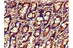 Immunohistochemistry of paraffin-embedded human small intestine tissue using ABIN7158996 at dilution of 1:100 (MARK3 抗体  (AA 368-667))