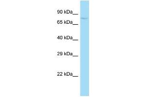 WB Suggested Anti-Sugp1 Antibody   Titration: 1. (Splicing Factor 4 抗体  (N-Term))