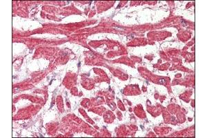 Heart, Human: Formalin-Fixed, Paraffin-Embedded (FFPE) (FABP7 抗体  (C-Term))