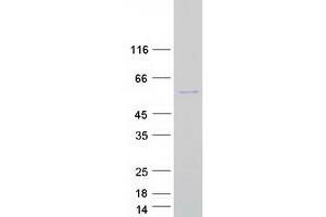SEC62 Protein (Myc-DYKDDDDK Tag)