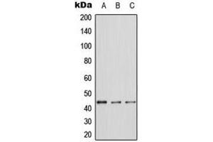 Western blot analysis of ERK1 expression in A431 (A), NIH3T3 (B), PC12 (C) whole cell lysates. (ERK1 抗体  (Center))