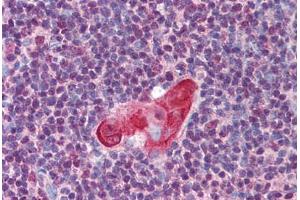 Human Thymus (formalin-fixed, paraffin-embedded) stained with TLX1 antibody ABIN297247 at 5 ug/ml followed by biotinylated goat anti-rabbit IgG secondary antibody ABIN481713, alkaline phosphatase-streptavidin and chromogen. (TLX1 抗体  (AA 300-330, AA 306-318))