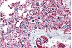Anti-NEK6 antibody  ABIN1049089 IHC staining of human testis. (NEK6 抗体  (N-Term))