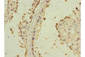 Immunohistochemistry of paraffin-embedded human testis tissue using ABIN7143441 at dilution of 1:100 (BST1 抗体  (AA 29-293))
