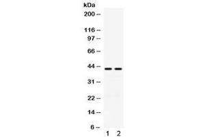 Western blot testing of human 1) A549 and 2) COLO320 cell lysate with RAD51C antibody. (RAD51C 抗体)