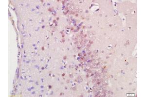 anti-Ras Association (RalGDS/AF-6) Domain Family (N-terminal) Member 8 (RASSF8) (AA 101-200) antibody