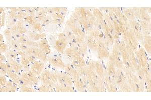 Detection of CD40L in Human Cardiac Muscle Tissue using Polyclonal Antibody to Cluster Of Differentiation 40 Ligand (CD40L) (CD40 Ligand 抗体  (AA 1-261))