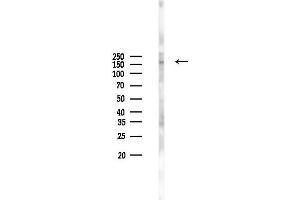 Western blot analysis of lysates from MCF7 cells(heat-shock,45 min treatment), using GAPV Antibody at 1/1000 dilution.