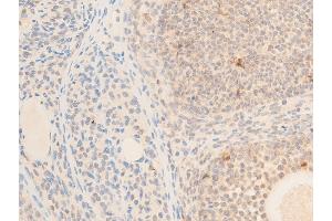 Immunohistochemistry (IHC) image for anti-Mitogen-Activated Protein Kinase Kinase Kinase 7 (MAP3K7) (pThr187) antibody (ABIN6256492)