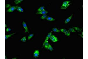 Immunofluorescent analysis of Hela cells using ABIN7169623 at dilution of 1:100 and Alexa Fluor 488-congugated AffiniPure Goat Anti-Rabbit IgG(H+L) (SPPL2A 抗体  (AA 26-172))