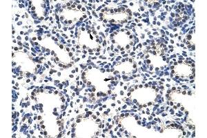 POP4 antibody was used for immunohistochemistry at a concentration of 4-8 ug/ml to stain Alveolar cells (arrows) in Human Lung. (RPP29 抗体)