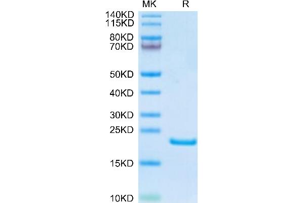 AGR2 Protein (AA 21-175) (His tag)