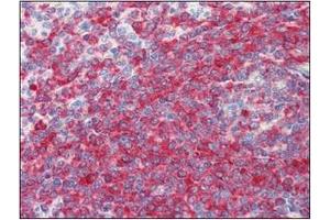 Immunohistochemistry (IHC) image for anti-Programmed Cell Death 4 (PDCD4) (AA 1-469), (N-Term) antibody (ABIN317548) (PDCD4 抗体  (N-Term))