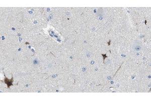ABIN6274610 at 1/100 staining Human brain cancer tissue by IHC-P. (Cell Adhesion Molecule 4 抗体  (C-Term))