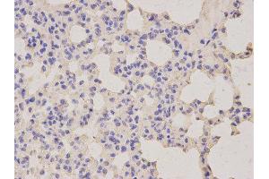 Immunohistochemistry (IHC) image for anti-Lipopolysaccharide-Induced Tumor Necrosis Factor-alpha Factor (LITAF) antibody (ABIN1876657) (LITAF 抗体)