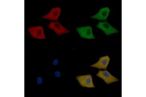 Peroxiredoxin 1 Mouse Monoclonal Antibody staining Hela cells by IF/ICC.