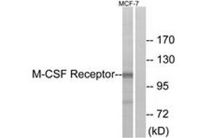 Western blot analysis of extracts from MCF7 cells, using M-CSF Receptor (Ab-723) Antibody. (CSF1R 抗体  (AA 691-740))