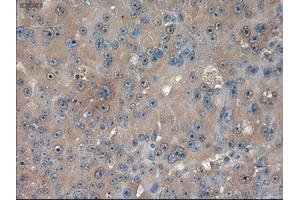 Immunohistochemical staining of paraffin-embedded kidney using anti-PTCH1 (ABIN2452537) mouse monoclonal antibody. (Patched 1 抗体  (AA 122-436))
