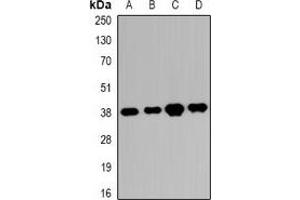 Western blot analysis of RRP7A/B expression in K562 (A), HEK293T (B), SHSY5Y (C), mouse eye (D) whole cell lysates. (RRP7A/B (C-Term) 抗体)