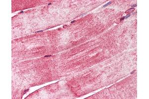 Anti-DNAJA3 / TID1 antibody IHC of human skeletal muscle. (DNAJA3 抗体  (C-Term))