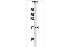 VPREB1 Antibody (Center) (ABIN1538592 and ABIN2838302) western blot analysis in CEM cell line lysates (35 μg/lane). (VPREB1 抗体  (AA 71-99))