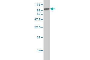 Western Blotting (WB) image for anti-serine/threonine Kinase 33 (STK33) (AA 1-514) antibody (ABIN566310)