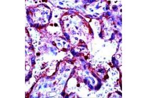 Immunohistochemical staining of human placenta stained with MMP9 polyclonal antibody  at 1 : 100 for 10 min at RT. (MMP 9 抗体)