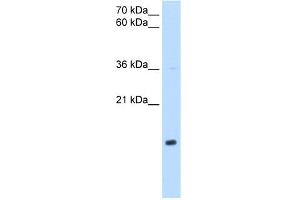 WB Suggested Anti-NDUFB5 Antibody Titration:  0. (NDUFB5 抗体  (Middle Region))